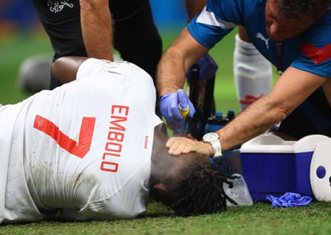 Breel Embolo gets the magic spray treatment.
