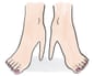 An illustration of a pair of feet with painted nails, with the heels distorted into the shape of stilettos