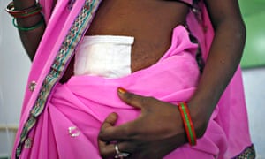 Woman after sterilsation surgery in Bilaspur