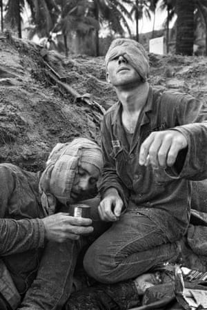 Medic Thomas Cole of Richmond, Virginia, looks up with his one unbandaged eye as he continues to treat wounded S.Sgt. Harrison Pell of Hazleton, Pennsylvania, during a firefight, January 30, 1966