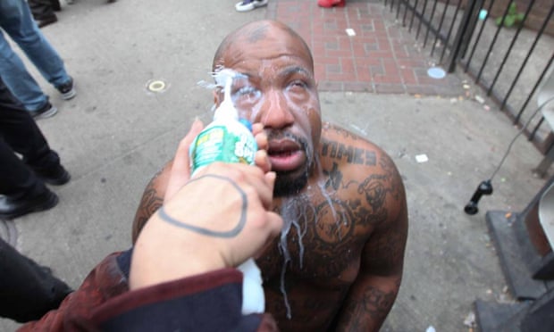 A water-milk mix is used to wash out a man’s eyes after he was hit with pepper spray.