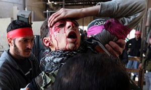 Free Syrian Army fighter holds his head, blood streaming down face