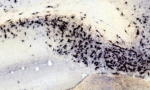 Alzheimer's research