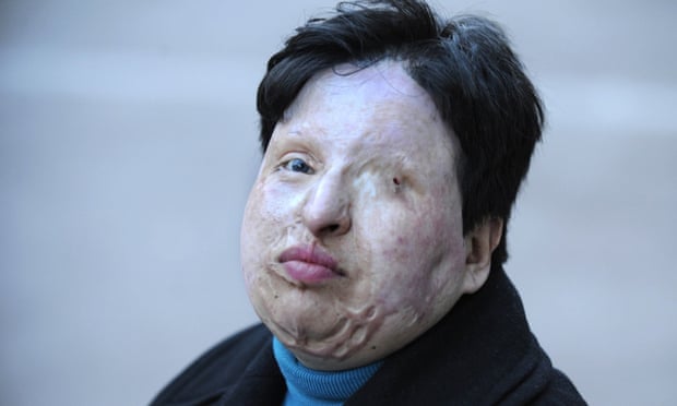 In 2011, Ameneh Bahrami, an Iranian woman who was blinded in an acid attack, pardoned her assailant