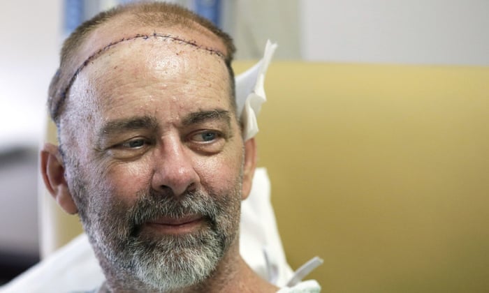 James Boysen is interviewed in his hospital bed at Houston Methodist hospital in Houston, Texas, after doctors said he received the world's first skull and scalp transplant.