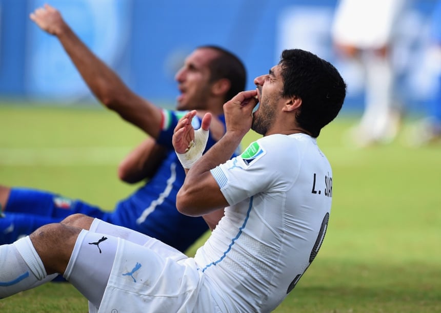 24 June: Luis Suarez of Uruguay clutches his teeth after biting Georgio Chiellini of Italy during the World Cup