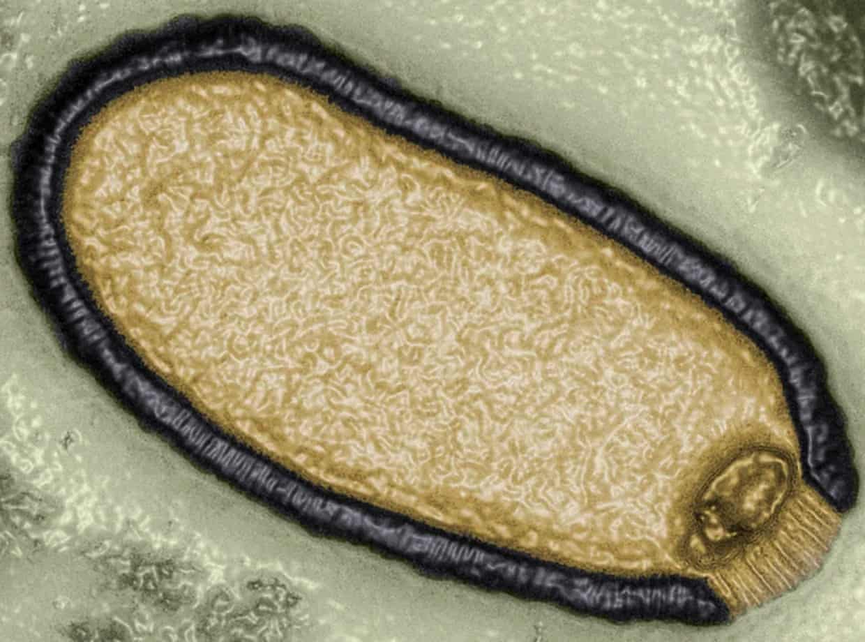 Computer enhanced image of a Pithovirus sibericum
