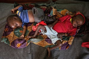 Twelve month old twins Elisabeth (left) and Sophie Bahawa were first treated for measles and then for acute malnutrition at the Baboua district hospital