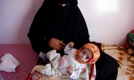 A mother carries her malnourished child as he receives treatment at Al-Sabeen hospital in Sana’a, Yemen, on 23 December 2019.