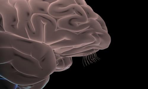 Brain Parasite Could Be Behind Rage Disorder In Adults Infectious Diseases The Guardian Brain Parasite Could Be Behind Rage Disorder In Adults Infectious Diseases The Guardian