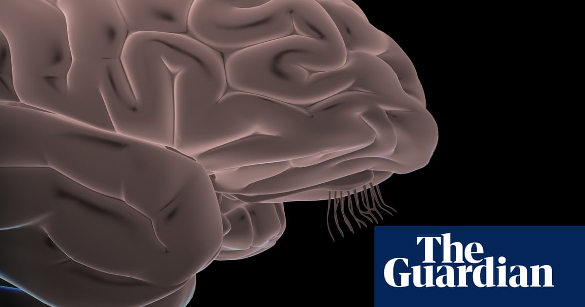 Covid 19 Virus Does Not Infect Human Brain Cells Study Suggests Medical Research The Guardian Covid 19 Virus Does Not Infect Human Brain Cells Study Suggests Medical Research The Guardian