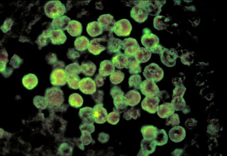 photomicrograph of green circles