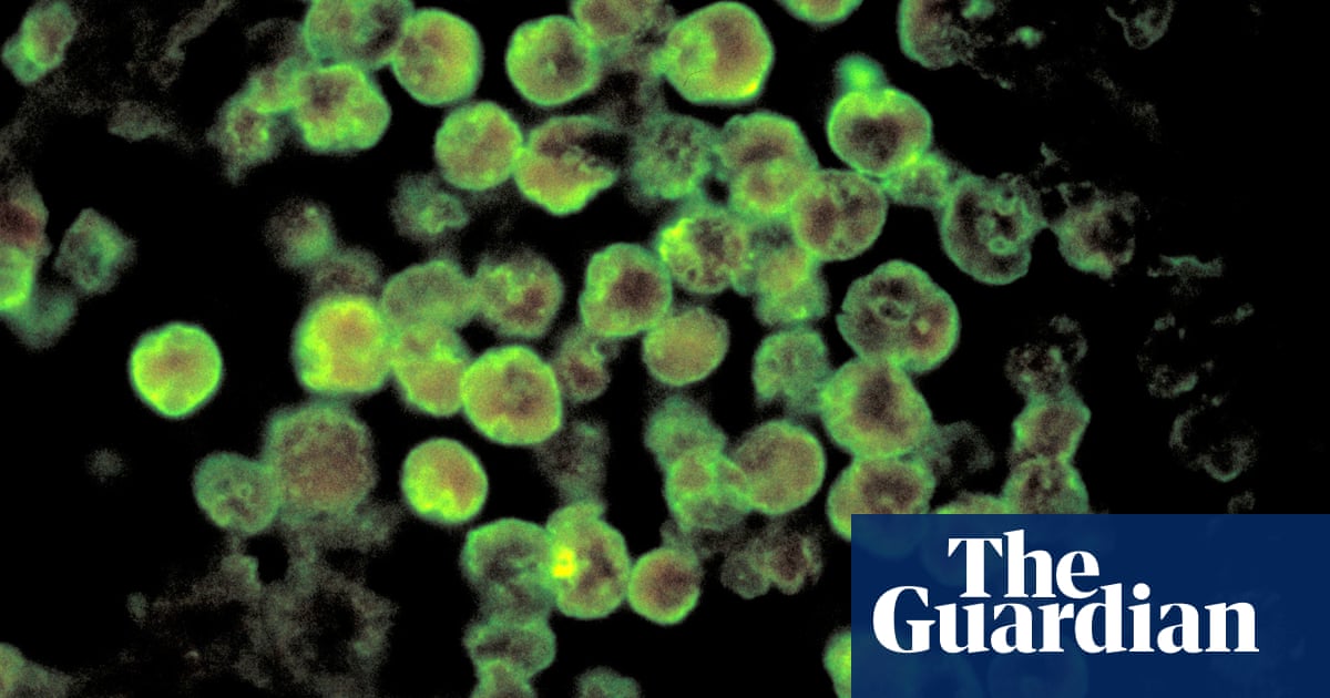 Georgia resident dies from rare braineating amoeba The Guardian US Georgia resident dies from rare braineating amoeba The Guardian US