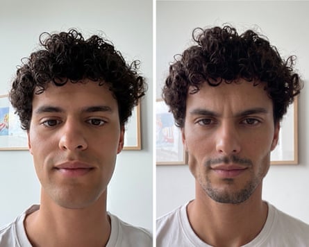 Before (left) and after AI’s ‘chad’ revisions, including a neck and brow lift.