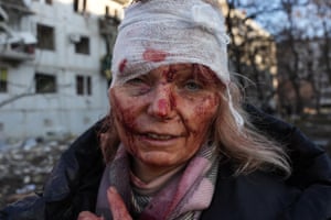 A wounded woman is seen as airstrikes damage an apartment complex outside of Kharkiv, Ukraine
