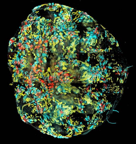 Image of a mini-kidney formed in a dish from human induced pluripotent stem cells.