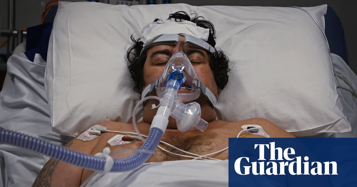A rare look inside a Sydney Covid-19 ICU ward as one man fights for his life – video