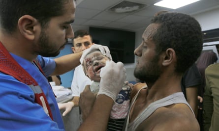 A wounded infant receives treatment at Al-Shifa Hospital.