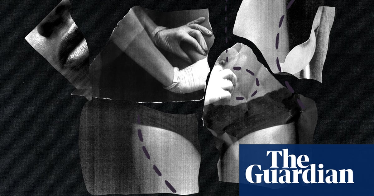 Dying For A New Body Why So Many Deaths From Plastic Surgery