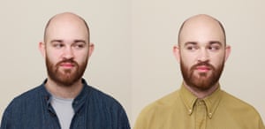 Left: Sam’s normal ‘before’ look; right, his new ‘natural’ look.