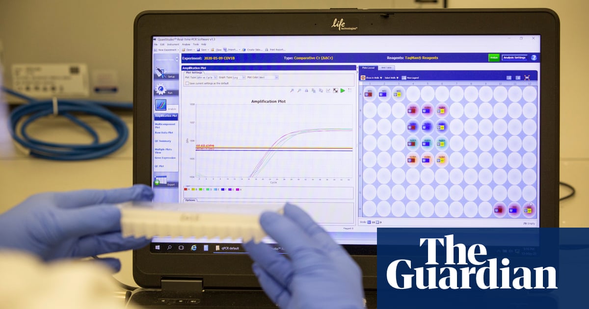 Covid testing failures at UK lab ‘should have been flagged within days’