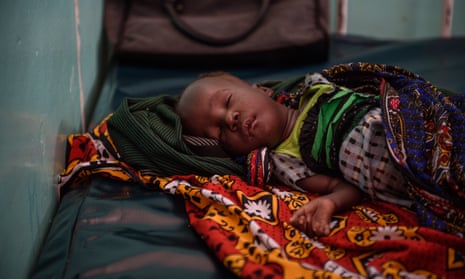 Eleven-month-old Akalapatan Kebo, who is suffering from acute malnutrition complicated by pneumonia, at Lodwar county and referral hospital in Kenya
