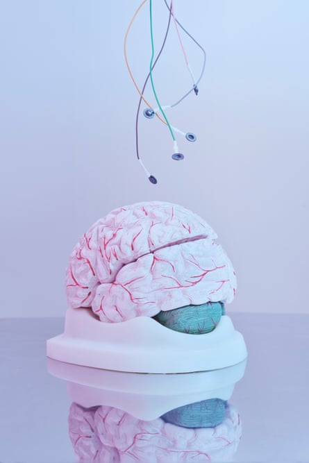 Model brain