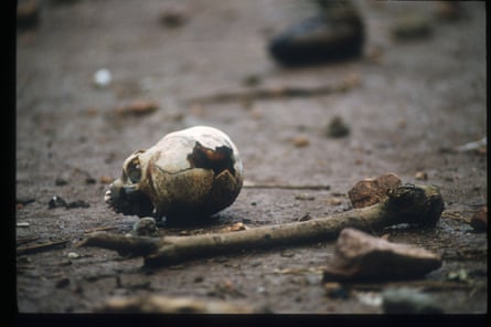 A human skull with a broken crown
