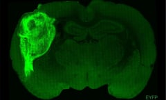A transplanted human organoid labelled with a fluorescent protein in a section of a rat brain.