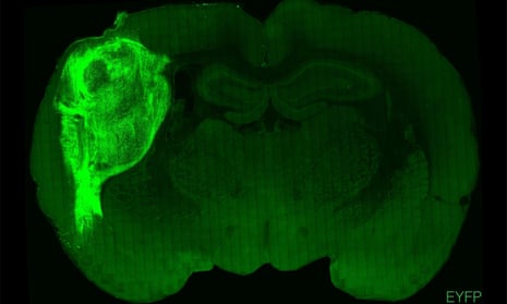 A transplanted human organoid labelled with a fluorescent protein in a section of a rat brain.