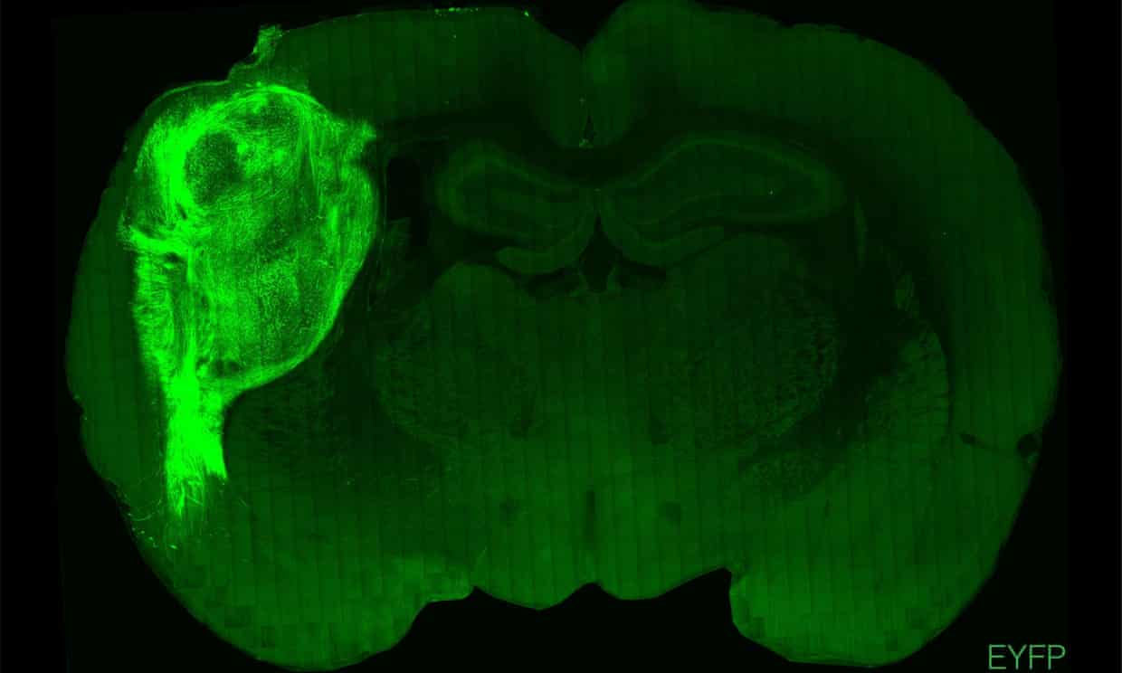 Brain Study: Human Cells Implanted into Rats