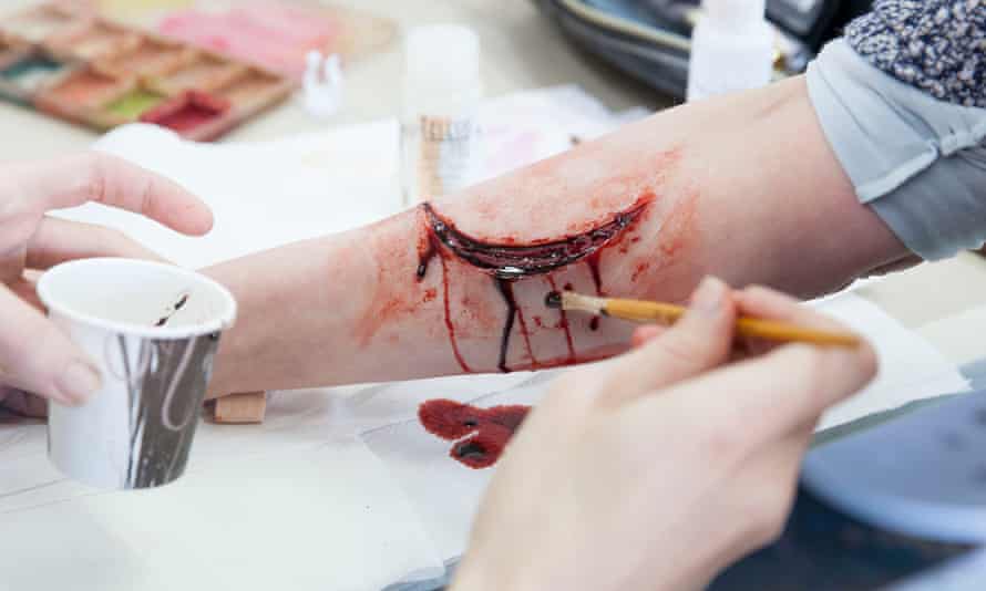‘It’s tasty’ … the finishing touches are put to Zoe’s arm wound.