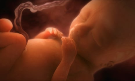 Human foetus in the womb