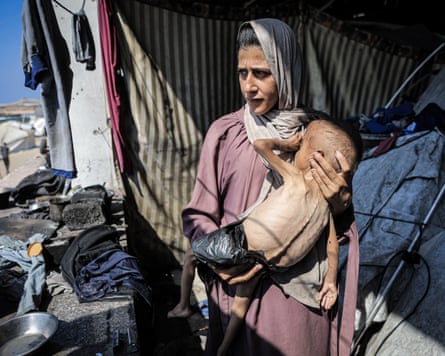 A woman holds a starving child in Gaza City