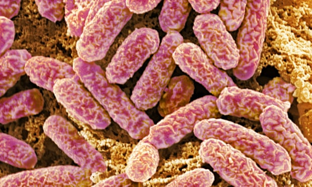 Darmbakterien E. coli