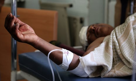 A Yemeni man receives treatment at a hospital after he was reportedly injured in a Saudi-led coalition airstrike.
