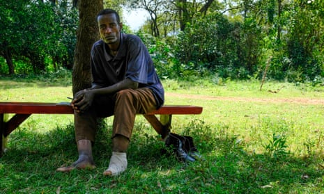 Manjore Merkeneh, a farmer in Dawro, Ethiopia, with podoconiosis, sits on a bench in a garden setting.