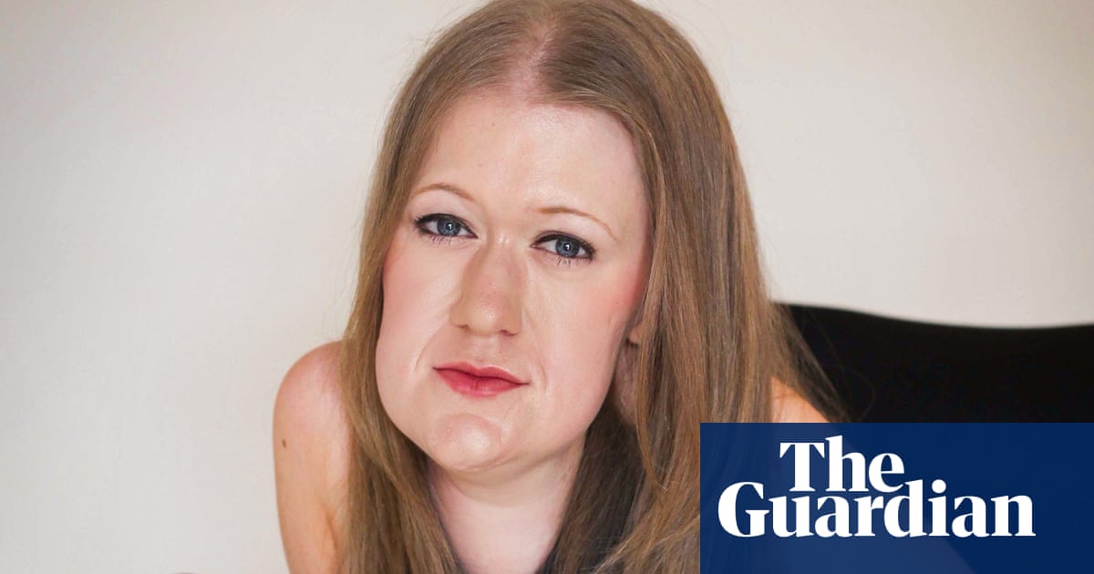 I'm still sick. I'm still disabled. But I'm proud of my body': Frances Ryan's manifesto for disabled women