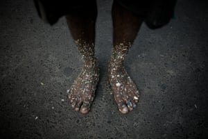 A dump worker’s feet covered with plastic pieces.
