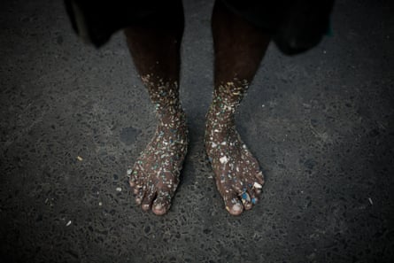 A dump worker’s feet covered with plastic pieces.