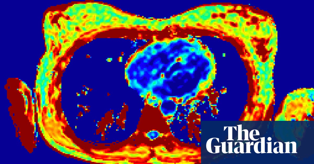New breast cancer scan is designed with women’s comfort in mind