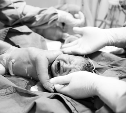 baby cries as gloved health workers’ hands reach toward it