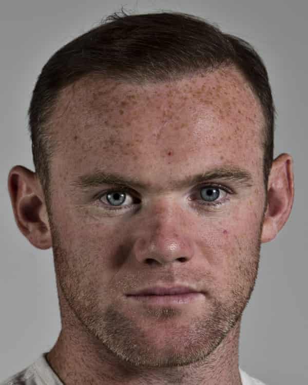 Restoration man: Wayne Rooney after his treatment.