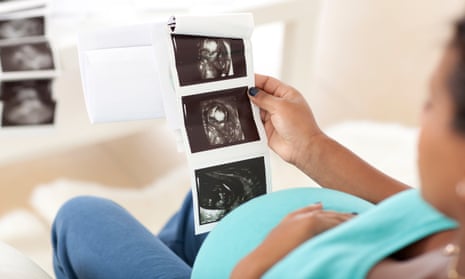 The rise in private scans may be partly explained by the shortage of 3,500 midwives in England.