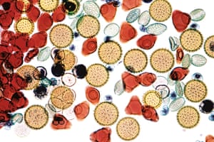 Pollen, which produces the sperm cells necessary for fertilisation of flowering plants, falls into one of two classifications – monocot or dicot (both are seen here). Monocot pollen has a single furrow or pore on its surface, dicots three. Many differences between plants are related to the two types of pollen.