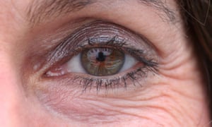 eye