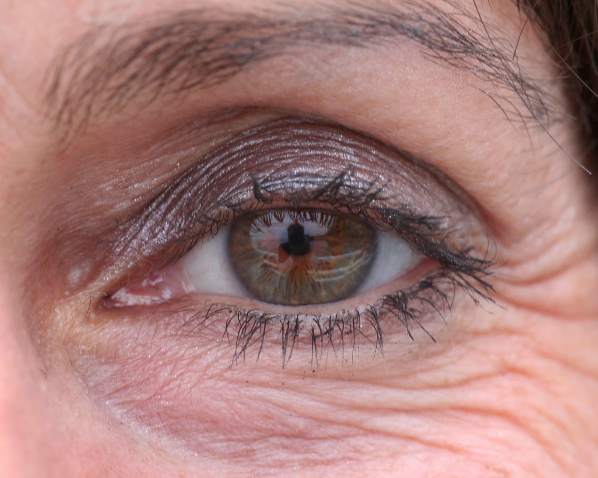Weight loss drugs linked to higher risk of eye damage in diabetic patients | Diabetes | The Guardian Weight loss drugs linked to higher risk of eye damage in diabetic patients | Diabetes | The Guardian