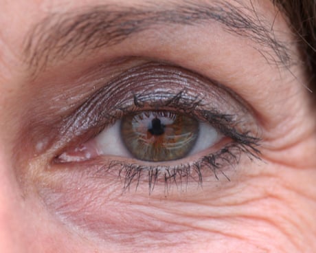 Weight loss drugs linked to higher risk of eye damage in diabetic patients