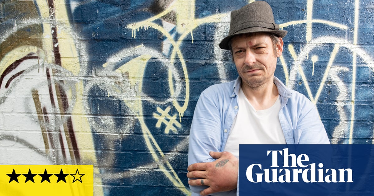 The Man With a Penis on His Arm review – TV that makes you proud to be British