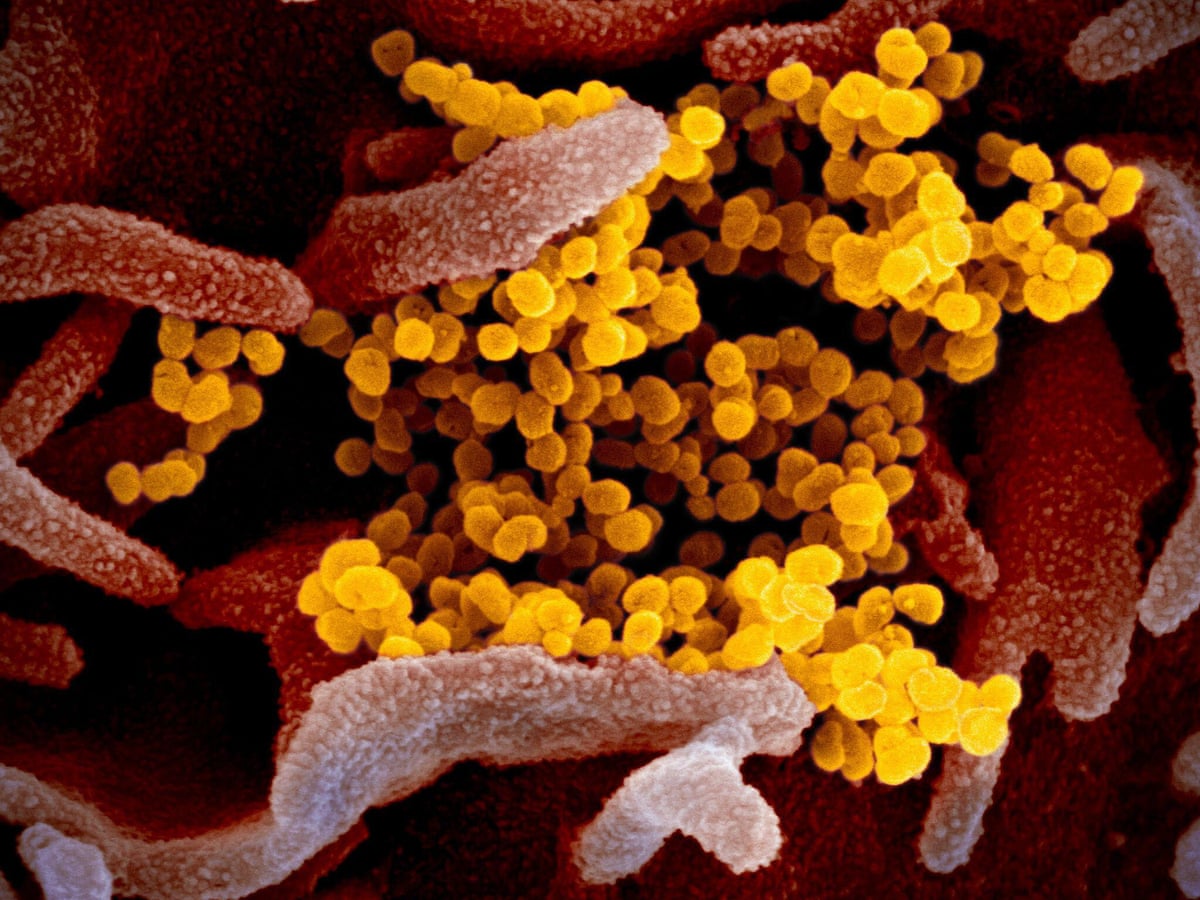 Us Germ Warfare Research Leads To New Early Covid 19 Test World News The Guardian